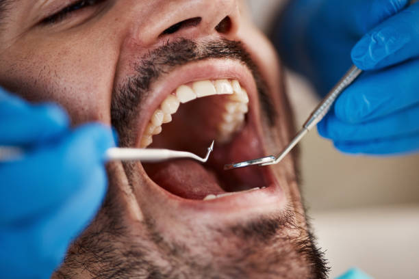 Best Emergency Treatment for Jaw Pain or Injury in Port Barrington, IL