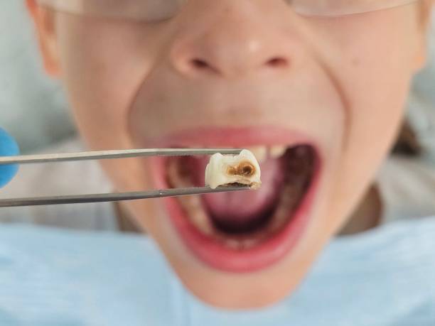 Best Emergency Dental Care for Sports Injuries in Port Barrington, IL